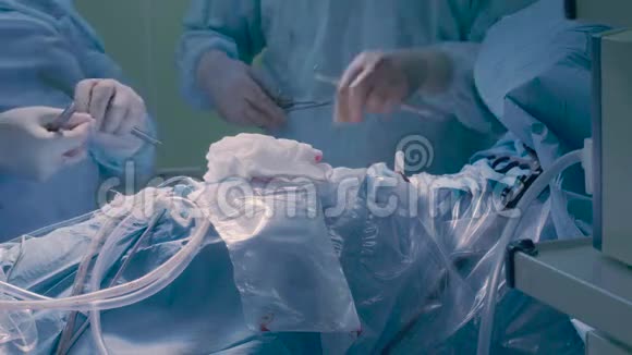 腹部外科手术缝合视频的预览图