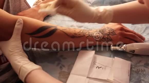 纹身去除激光一个年轻女孩用激光去除纹身视频的预览图