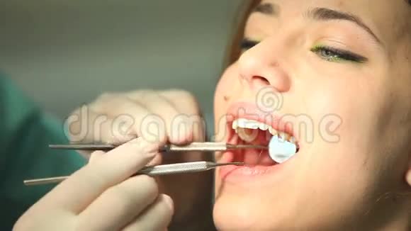 牙医视频的预览图