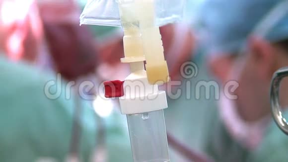手术室静脉滴血视频的预览图