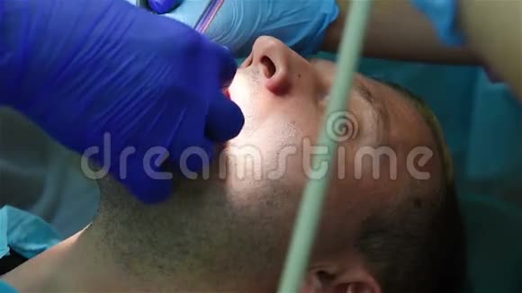 牙科植入手术视频的预览图