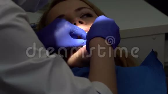 在牙科检查牙齿的女人视频的预览图