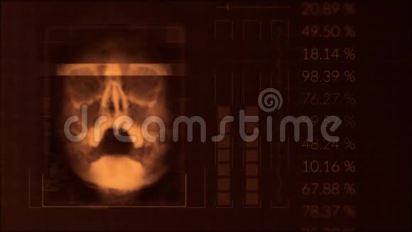 扫描一个人的头骨循环红色的hud接口医疗设备视频的预览图