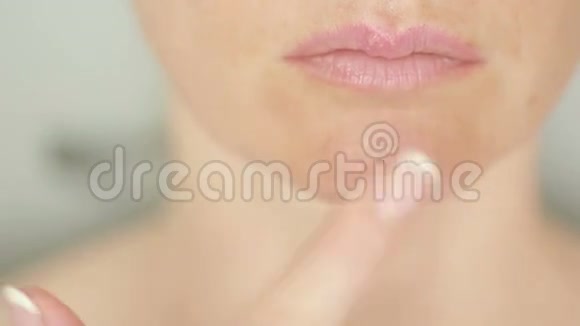 女孩在嘴唇上碰疮疱疹口唇治疗视频的预览图