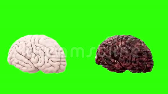 健康大脑和疾病大脑在绿色屏幕上旋转尸检医学概念癌症和吸烟问题视频的预览图
