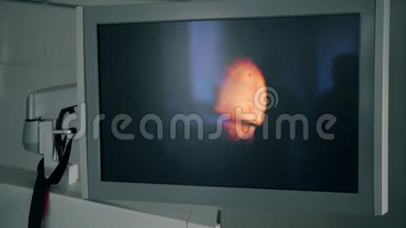 手术间的监视器视频的预览图
