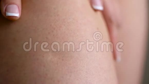 女性臀部皮肤上的拉伸痕迹视频的预览图