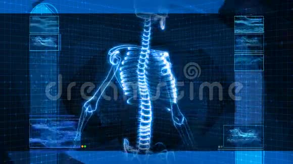 人脊柱X射线HD视频的预览图