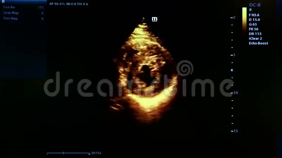 怀孕超声波监视器的彩色镜头视频的预览图