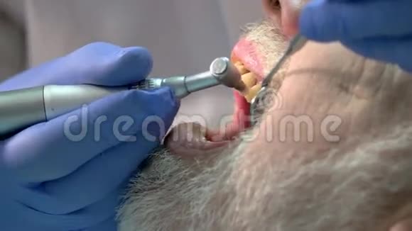 牙医清洁病人的牙齿视频的预览图