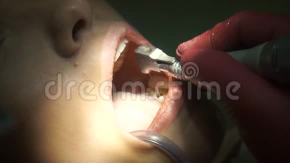 女孩从牙医那里治疗牙齿视频的预览图