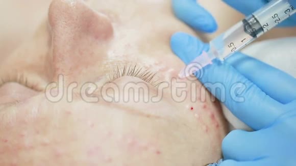 在诊所内注射美容治疗皮肤保养视频的预览图