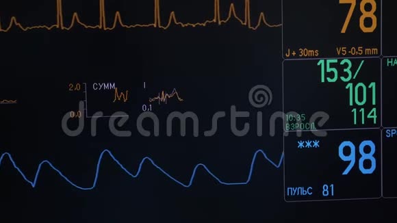 心电监护仪显示病人在手术室情况视频的预览图
