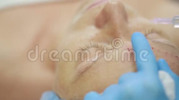 在诊所内注射美容治疗皮肤保养视频的预览图