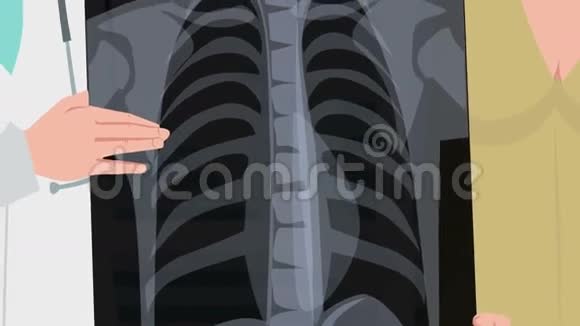 卡通诊所病人胸部X线片视频的预览图