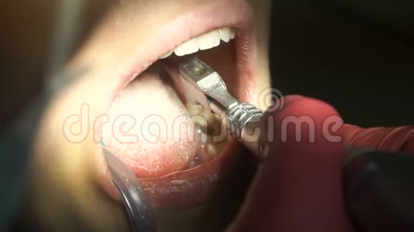 牙医的女口视频的预览图