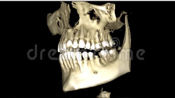 口腔医学牙科研究新质量医学牙科影像动画的人颌骨成像扫描视频的预览图