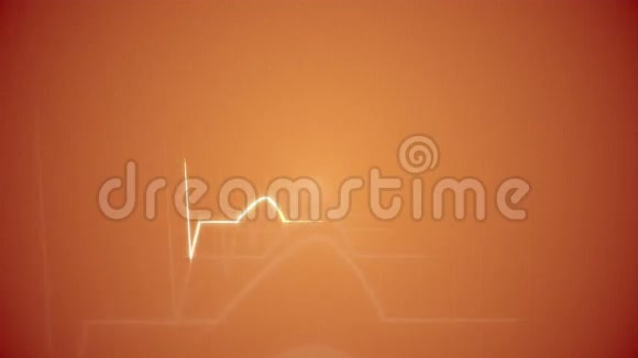 橙色背景下的心脏跳动卡视频的预览图