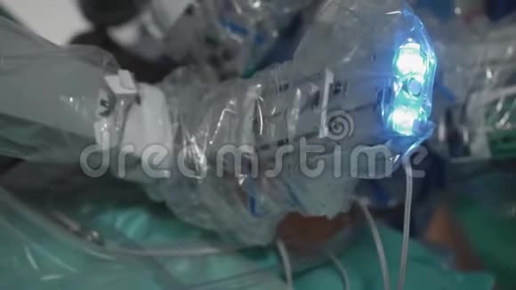 现代医学外科机器人肿瘤切除手术机器人手术视频的预览图
