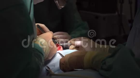 外科医生和他的助手做鼻子整容手术视频的预览图