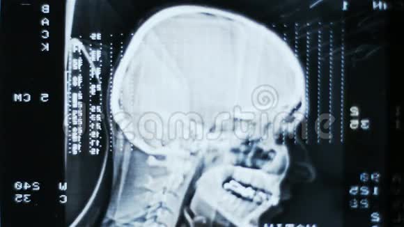 发光和辐射MRI扫描视频的预览图