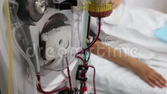透析医疗器械与患者视频的预览图