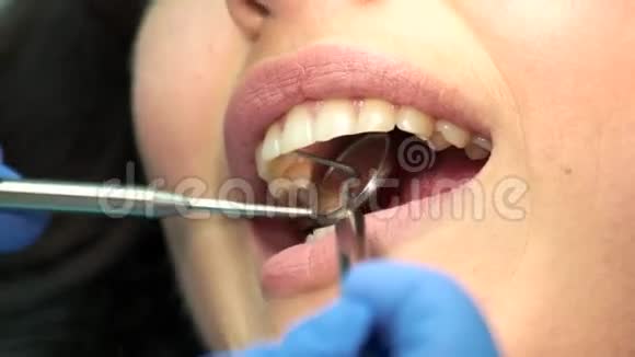 牙齿病人的嘴视频的预览图