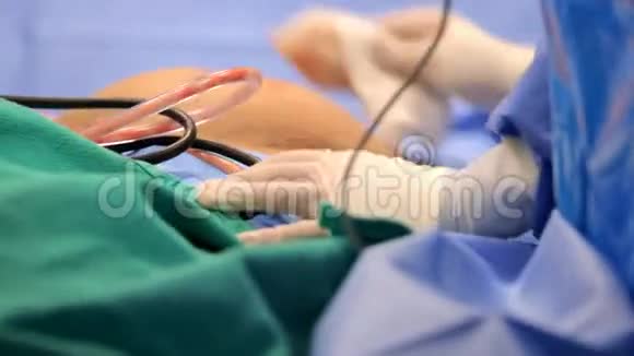 整形外科是手术室视频的预览图