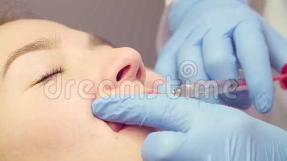 隆唇期间病人的面部视频的预览图