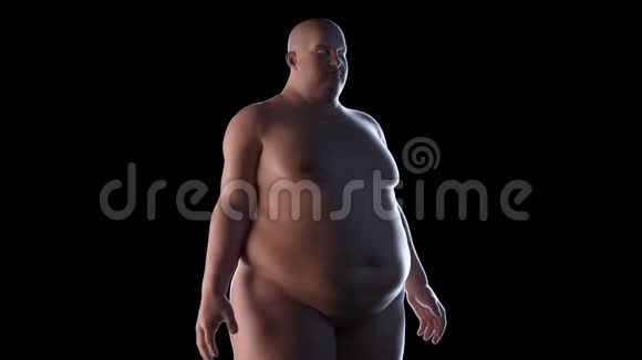 一个肥胖的男人视频的预览图