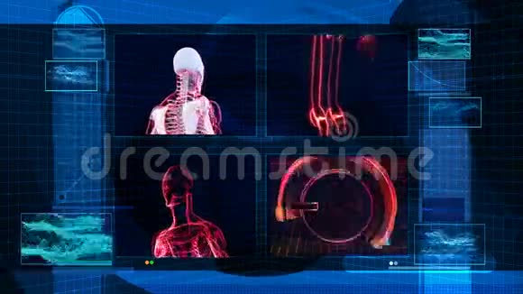 医疗扫描X射线技术数据高清循环视频的预览图