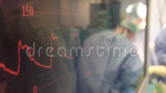 心脏监护仪视频的预览图