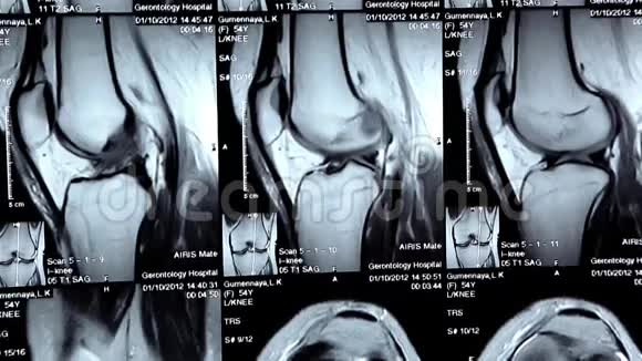 医生办公室的X光照片视频的预览图