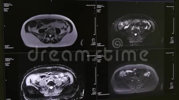 核磁共振扫描的脑部断层扫描视频的预览图