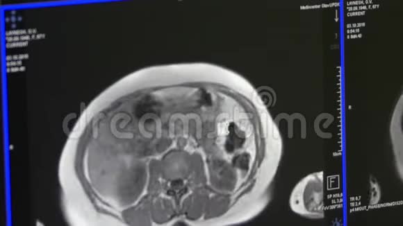 核磁共振扫描的脑部断层扫描视频的预览图