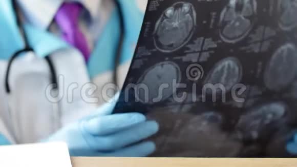 住院医生看头颅MRI或CT扫描视频的预览图