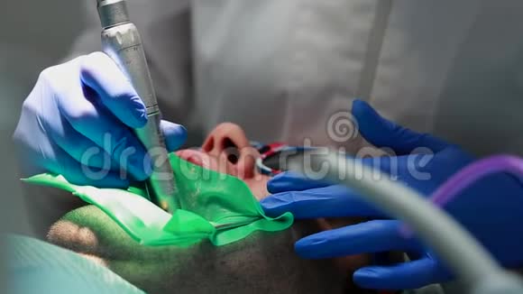 牙医和护士修理病人的牙齿用子钻牙去除蛀牙视频的预览图