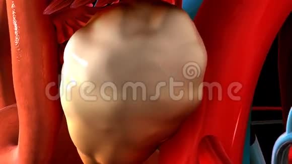 腹腔镜卵巢钻孔视频的预览图