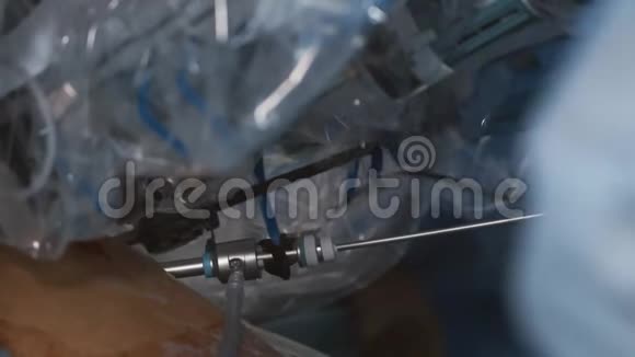 现代医学外科机器人肿瘤切除手术机器人手术视频的预览图