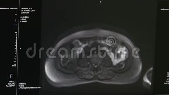 专业医疗设备MRI扫描的脑部断层扫描视频的预览图