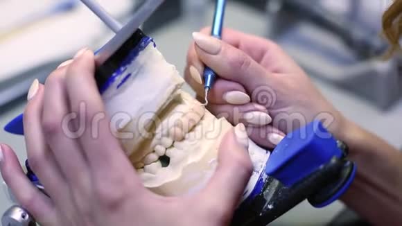 牙齿人类植入物牙科概念陶瓷人牙齿或假牙黑色背景特写植入物视频的预览图