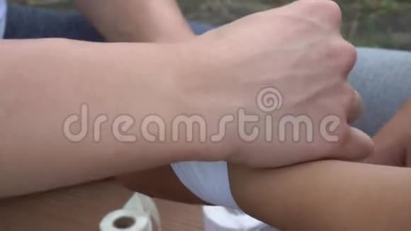 一个人用白色石膏覆盖另一只手的一部分它受伤了人类完成了手的覆盖开始视频的预览图
