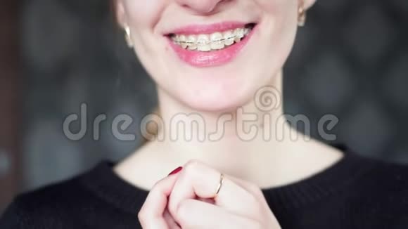 肖像一个戴着牙套的年轻女孩正在看相机牙齿对齐和下巴矫正口腔护理青年视频的预览图