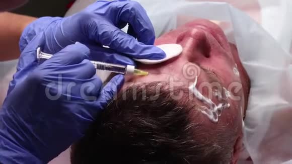 整形外科医生的手在病人脸上画轮廓用于面部轮廓整形的手术视频的预览图