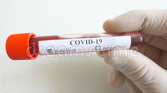 带防护手套的医生手臂中的COVID19血样医生手拿着试管和血样视频的预览图