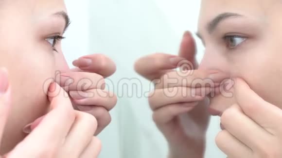 欧洲年轻美丽的女人挤压她的粉刺从她的脸上消除粉刺女性护肤理念视频的预览图