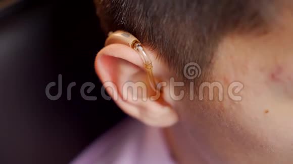 一个年轻人从他的耳朵上取出一个带有个人耳机的数字助听器耳聋特写镜头视频的预览图