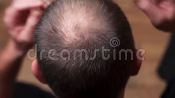 有脱发问题的男人特写头部顶部集中向下看显示头部的秃头部分视频的预览图