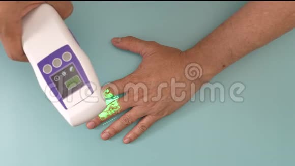 技术人员使用静脉扫描仪设备来可视化病人手臂上静脉视频的预览图