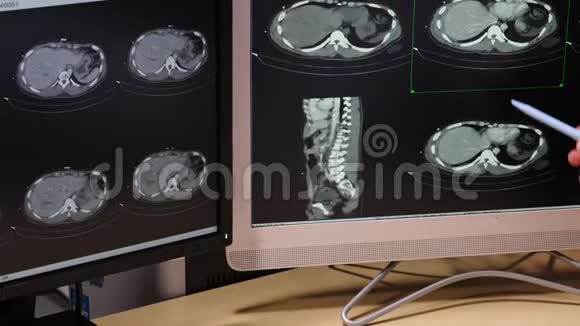 一位医生在他的办公室检查CT图像视频的预览图